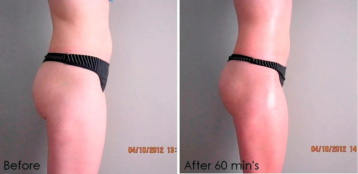 Biominceur Centurion Slimming & Beauty Salon photo 1