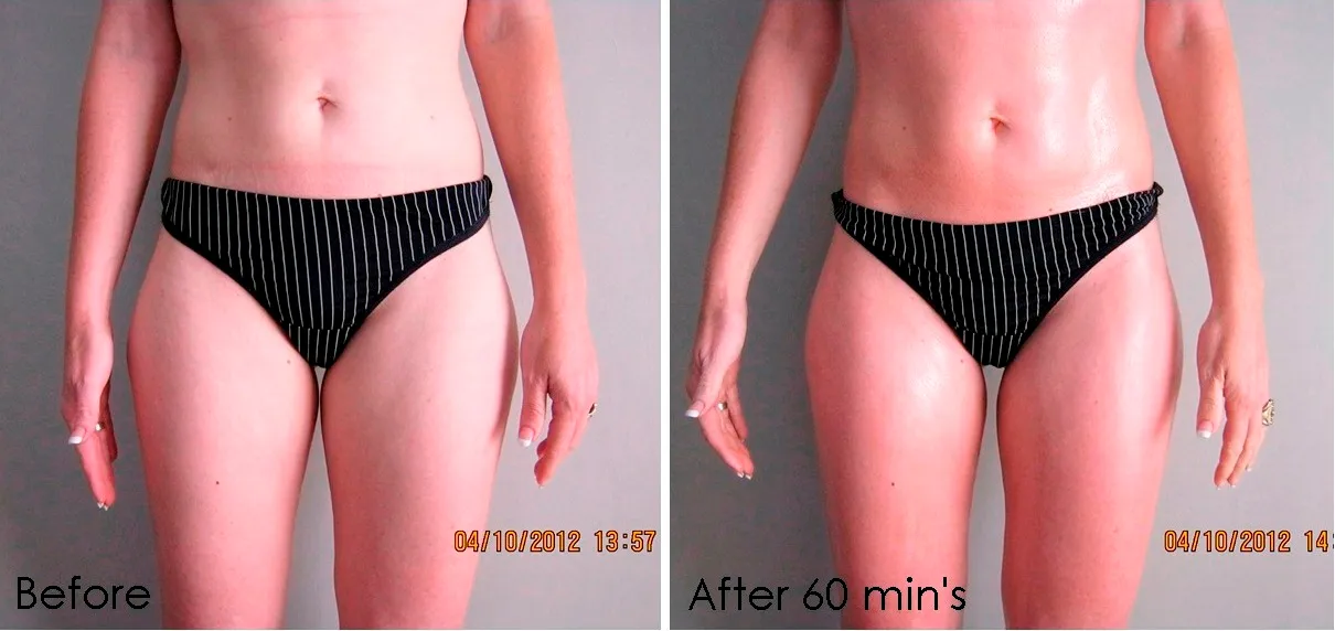 Biominceur Centurion Slimming & Beauty Salon photo 3