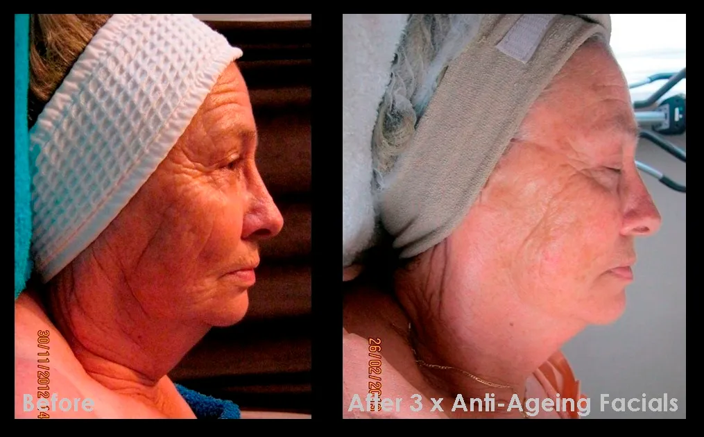 Biominceur Centurion Slimming & Beauty Salon photo 4