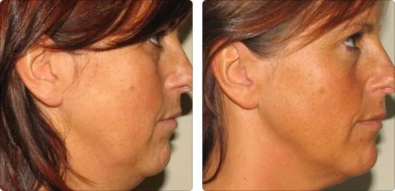 Durban Laser Clinic photo 4