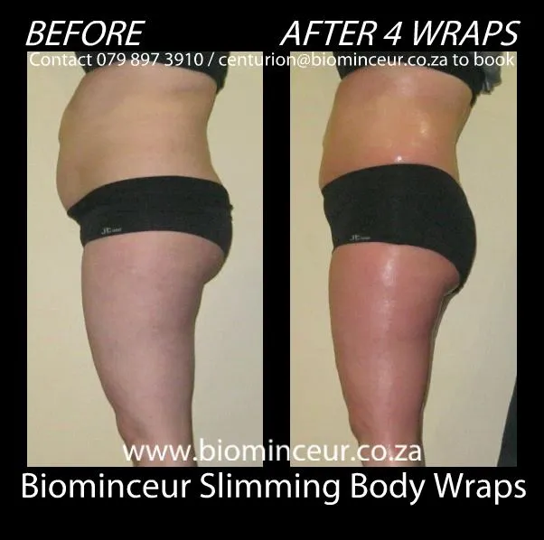 Biominceur Slimming Wrap photo 1
