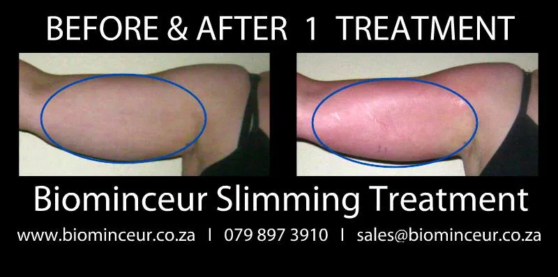 Biominceur Slimming Wrap photo 2