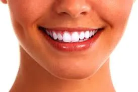 Advance Teeth Whitening photo 2
