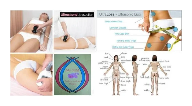 MySliM - Non-Surgical Ultrasound Liposuction logo