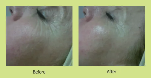 Celebrity Skincare photo 1