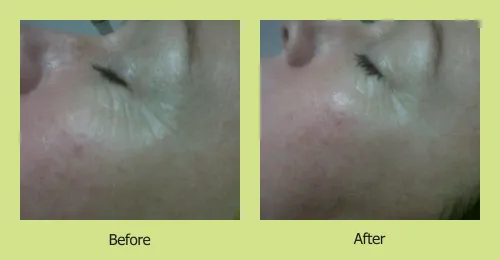 Celebrity Skincare photo 2