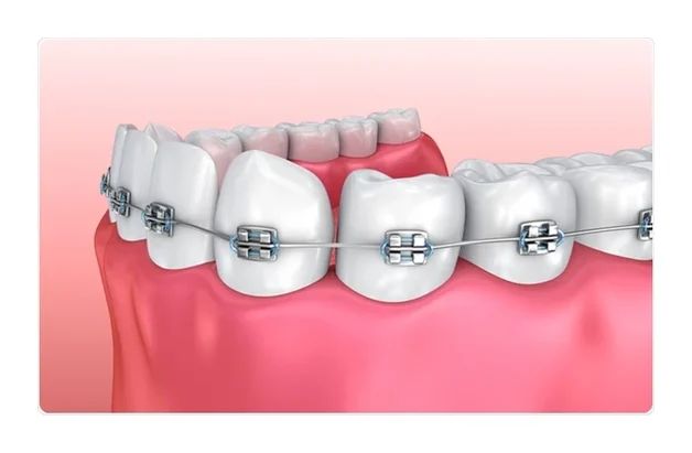 Palm Centre_Dentist, Braces near me logo